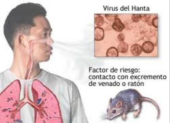 Thông tin báo chí về bệnh do vi rút Hanta và các biện pháp phòng bệnh